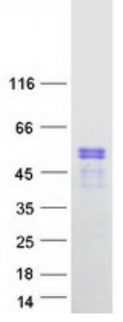 SDS PAGE (PBX2-113H).jpg